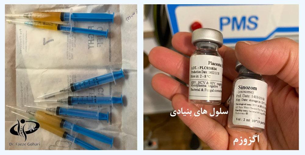 ترکیب پیآرپی، سلولهای بنیادی و اگزوزوم