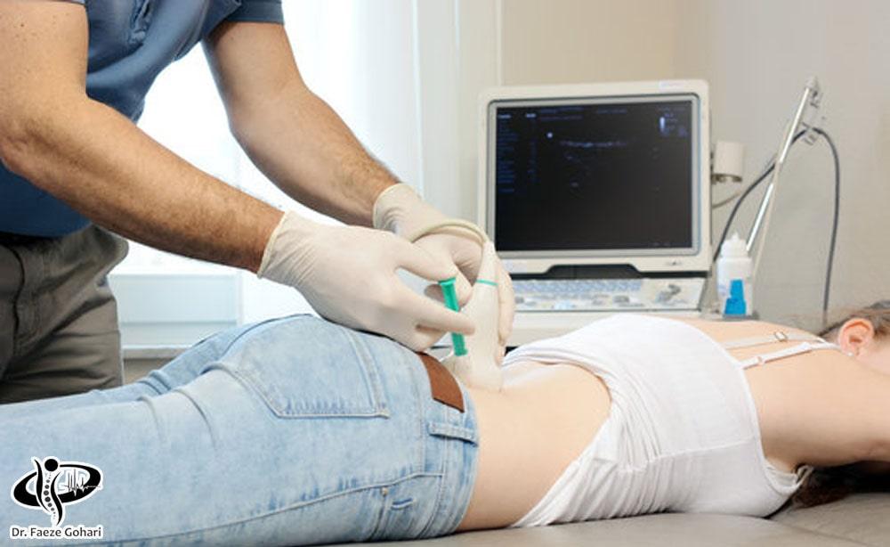 تزریق کوکتل سلولهای بنیادی و PRP