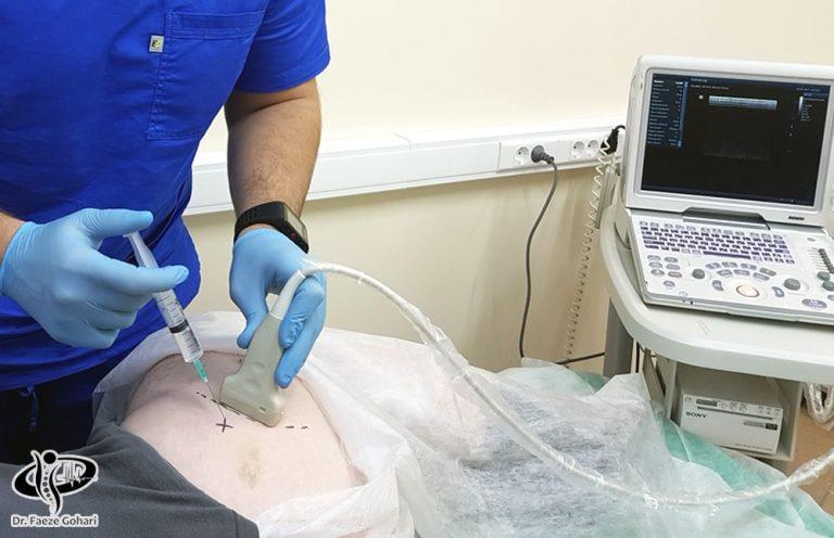 درمان دیسک کمر و درد سیاتیک