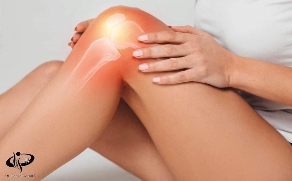 درمان پارگی مینیسک 