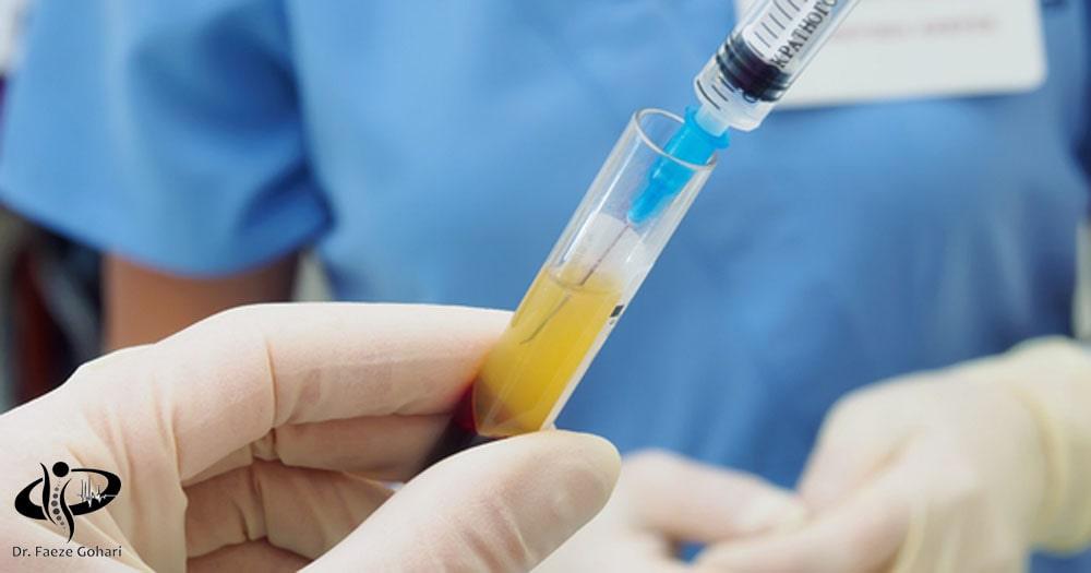 آماده سازی محلول پی آر پی