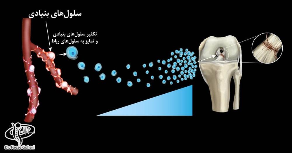 تکثیر سلولهای بنیادی و تمایز به سلولهای رباط