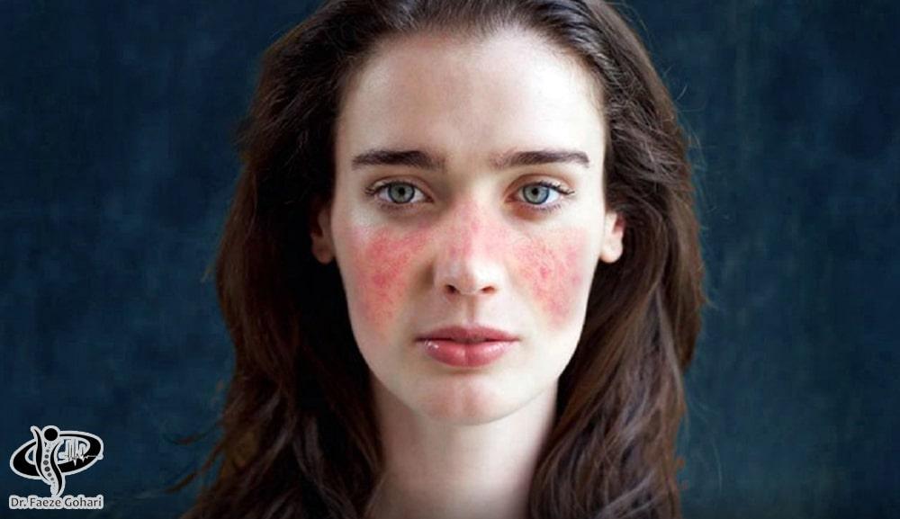 سلامت عمومی تأثیر زیادی بر اثربخشی این روش درمانی دارد