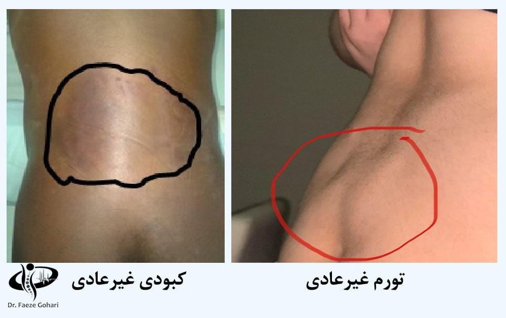 عوارض نادر و بلند مدت