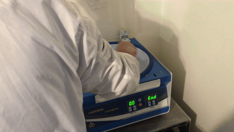 جدا کردن اجزای خون با دستگاه سانتریفیوژ