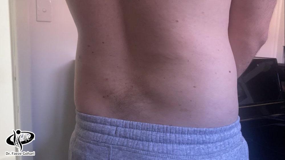 عوارض موقتی