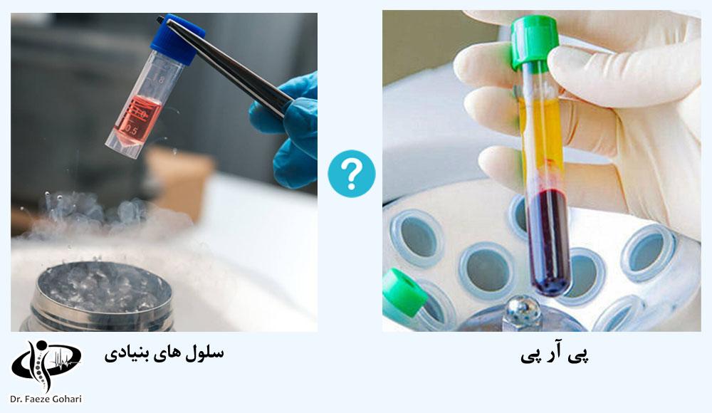 مکانیسم تزریق سلولهای بنیادی وPRP