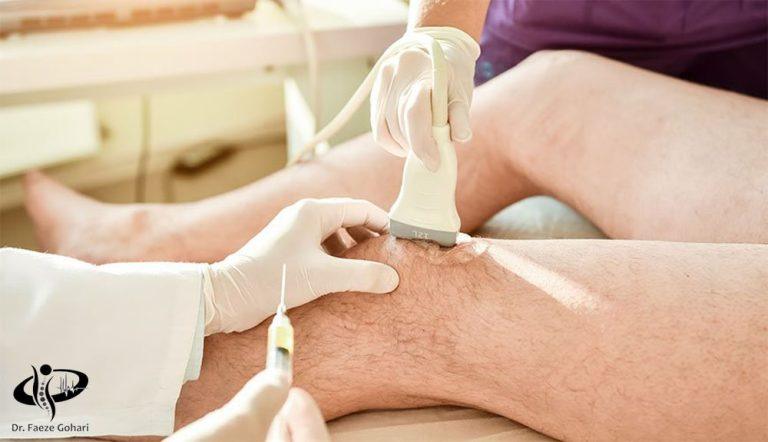 درمان پارگی مینیسک زانو