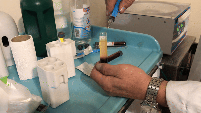 کشیدن پلاکت