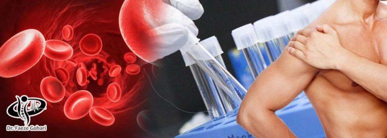 تاندون شانه