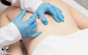 آمپول کمردرد