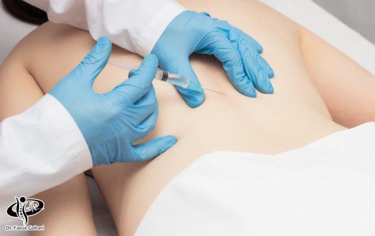 آمپول کمردرد