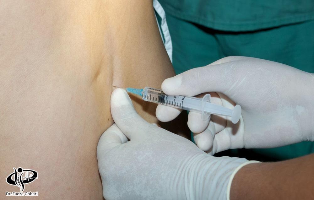 انتخاب آمپول مناسب برای تنگی کانال نخاعی