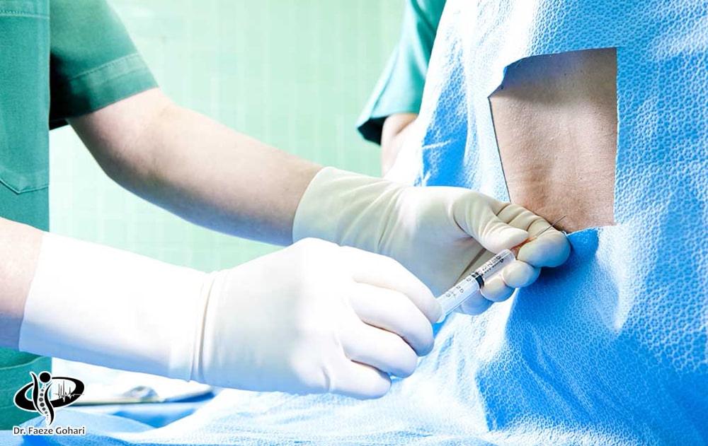 تزریق کورتون