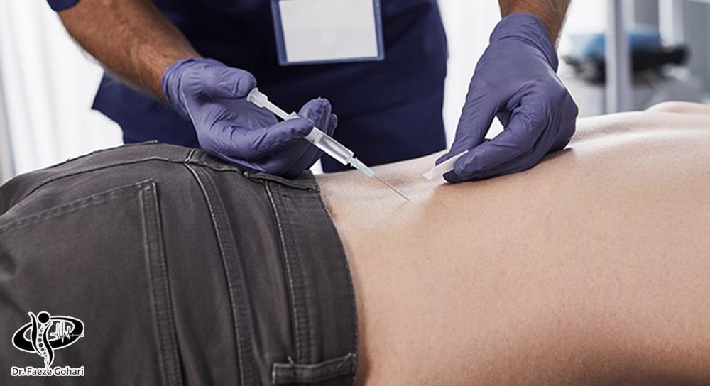 تزریق داروهای کورتیکواستروئیدی