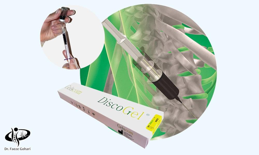 تزریق دیسکوژل