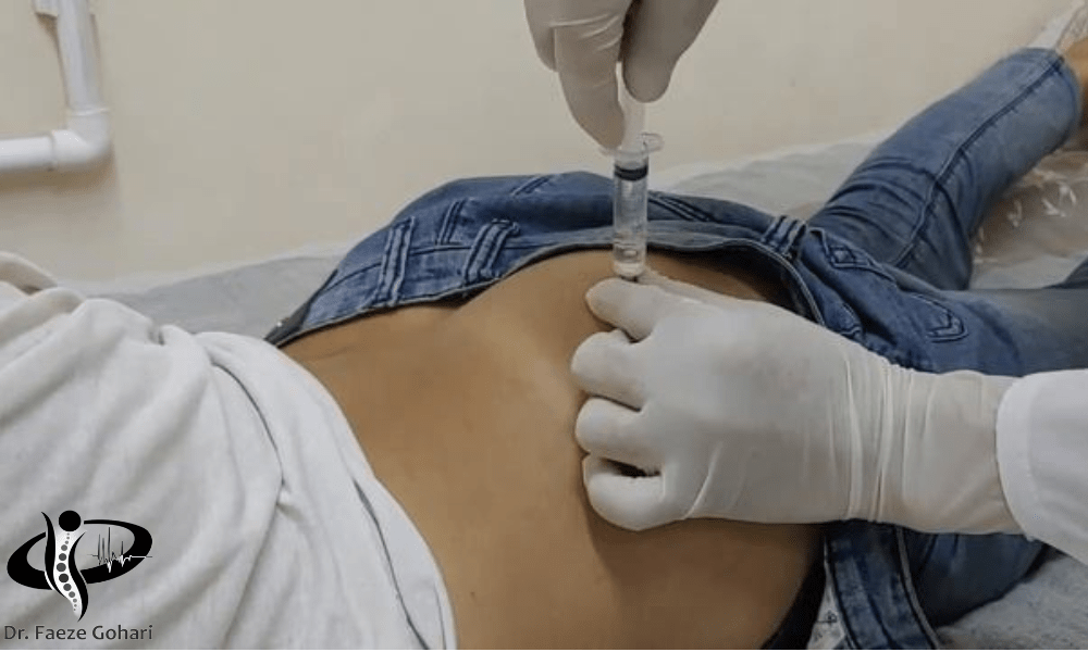 آمپولهای عضلانی