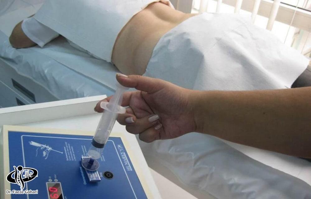 تزریق گاز اوزون