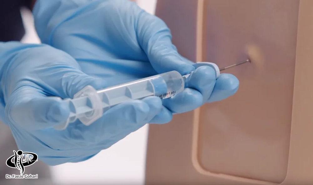 تزریق اوزون