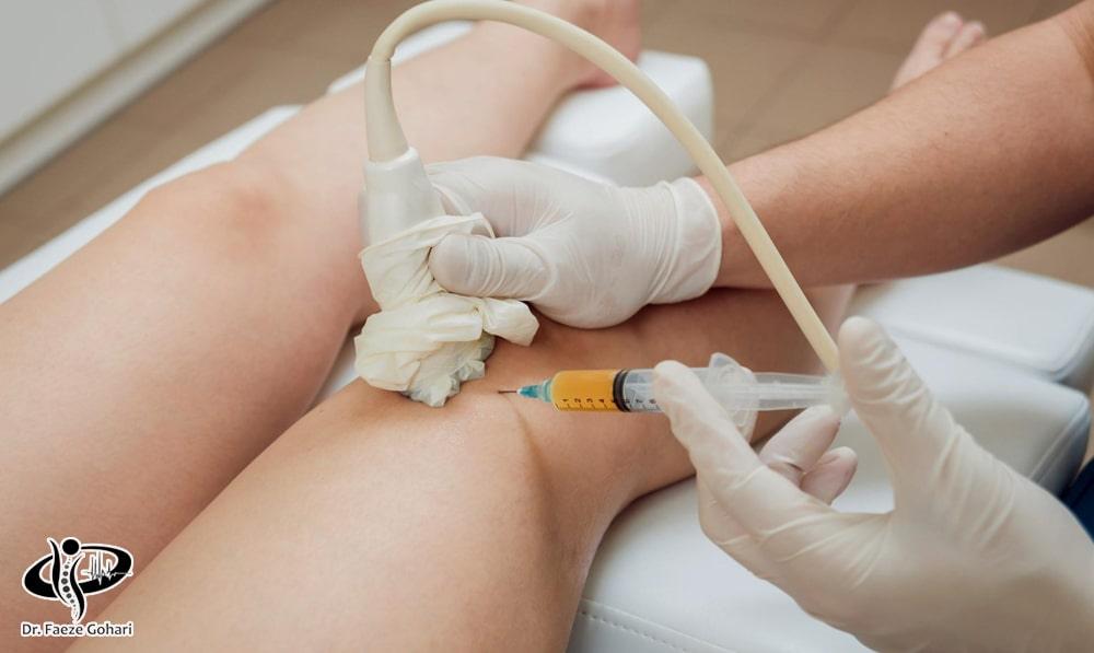 آمپول پیارپی برای زانو درد