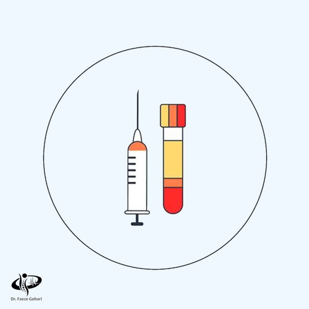 تهیه پی‌آرپی(PRP)