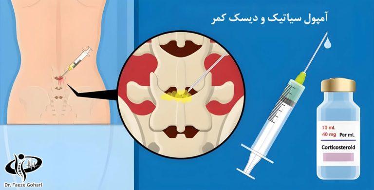آمپول سیاتیک و دیسک کمر