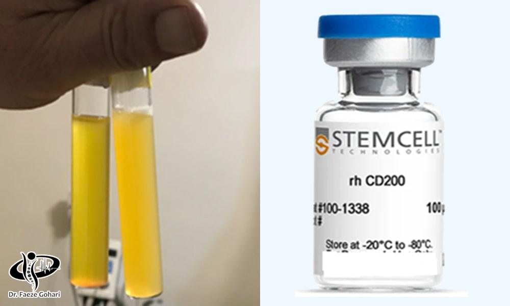 سلول‌های بنیادی با پی آر پی 