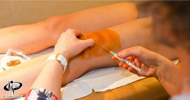 درمان زانو درد با آمپول