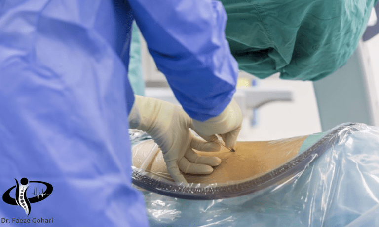 تنگی کانال نخاعی