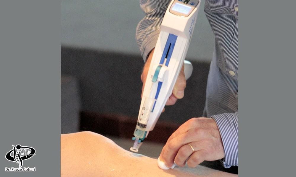 مزوتراپی برای درمان زانو درد