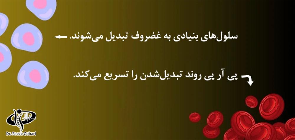 درمان آرتروز شانه با سلول های بنیادی و پی آر پی