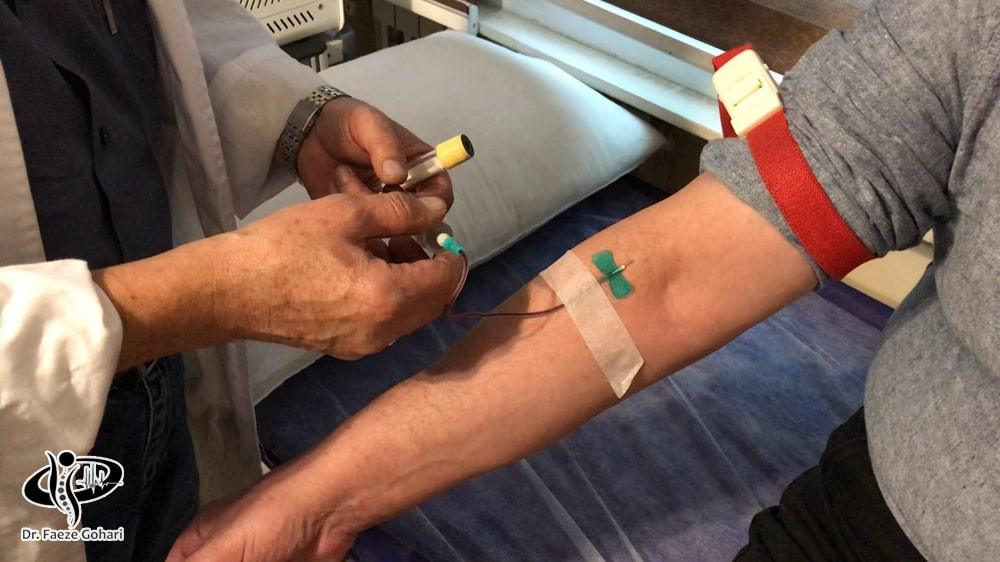 فرایند تزریق