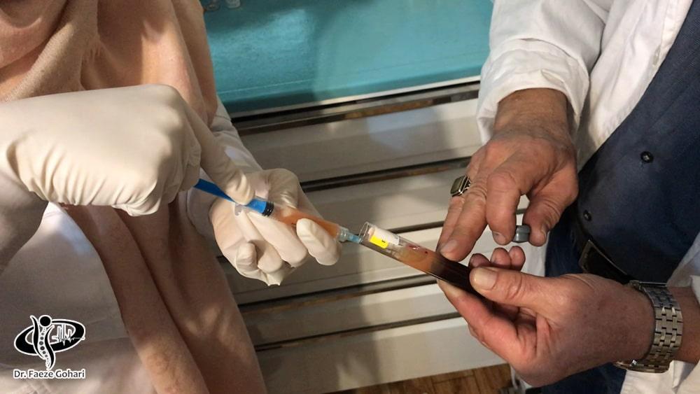 تهیه پی آر پی (PRP)