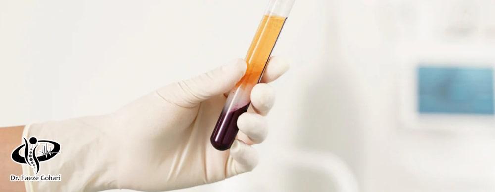 پیآرپی (PRP) مخفف Platelet-Rich Plasma به معنی پلاسمای غنی از پلاکت