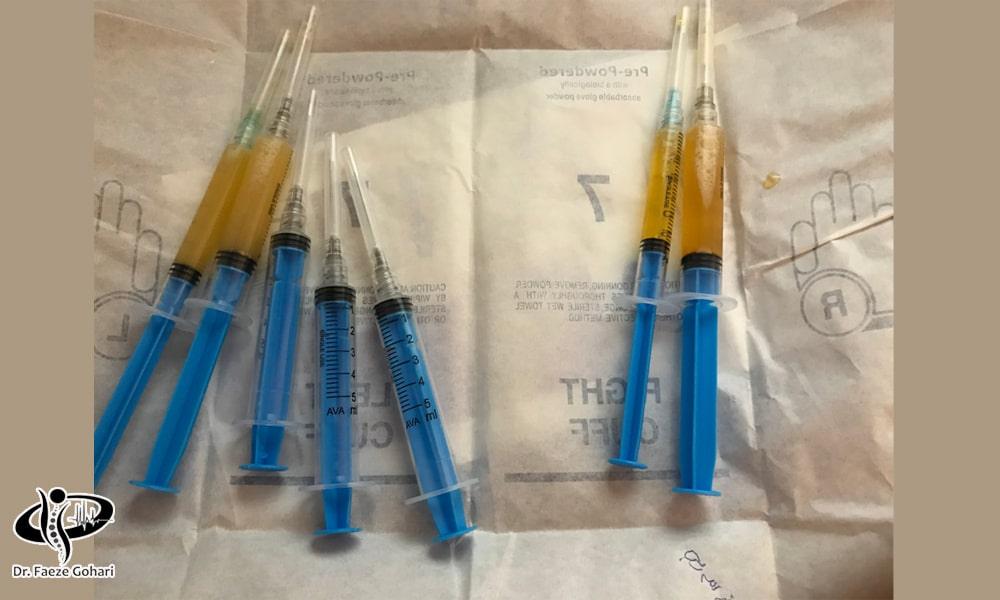 تهیه کوکتل تزریقی 