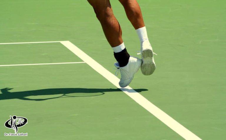 درمان پارگی رباط مچ پا