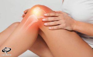 درمان نرمی غضروف زانو یا کندرومالاسی با پی‌آرپی و سلول بنیادی