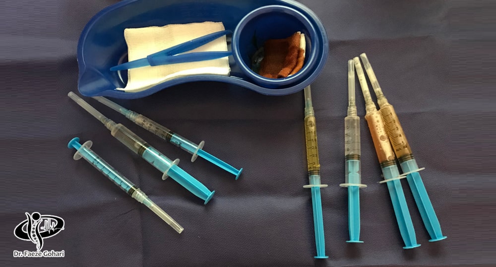 تسریع روند ترمیم و کاهش درد ناشی از تزریق