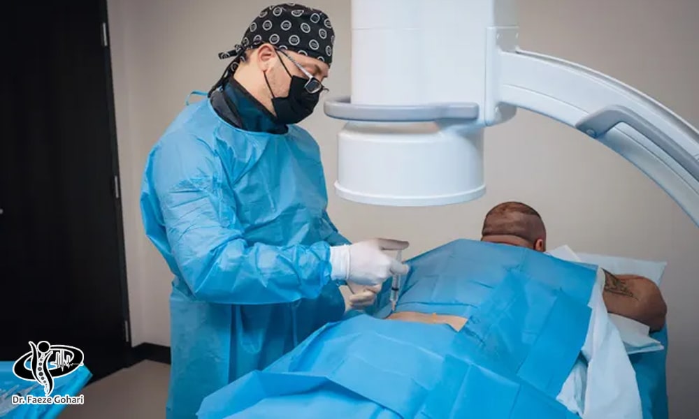 نحوه تزریق سلول‌های بنیادی و پی ار پی به کمر