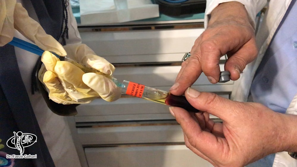 درمان با سلولهای بنیادی و پی ار پی