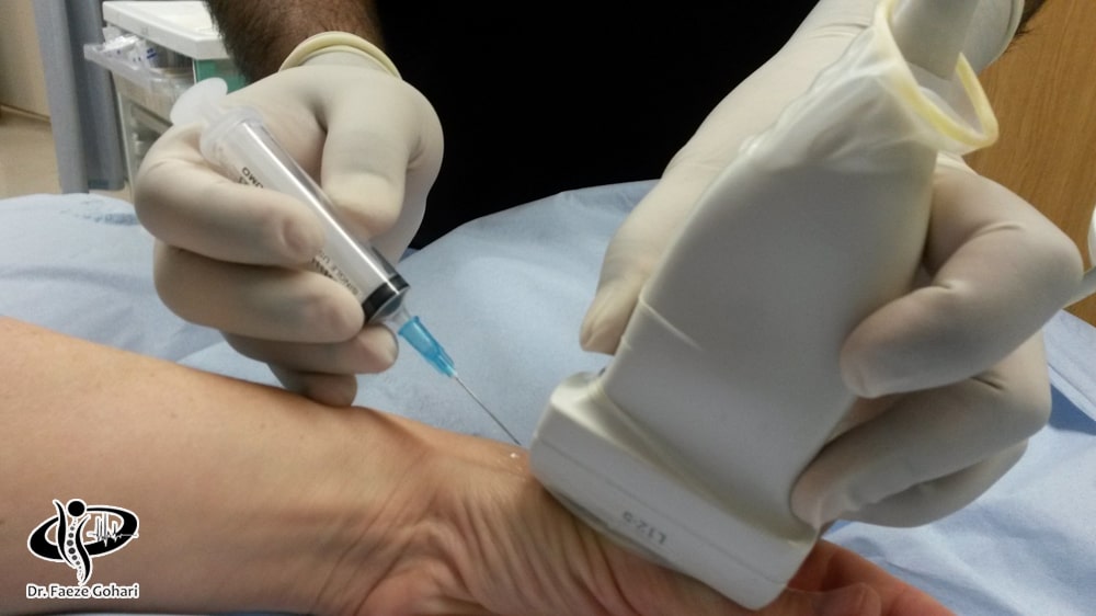 فرایند تزریق سلول‌های بنیادی 