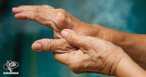 آرتروز شست دست