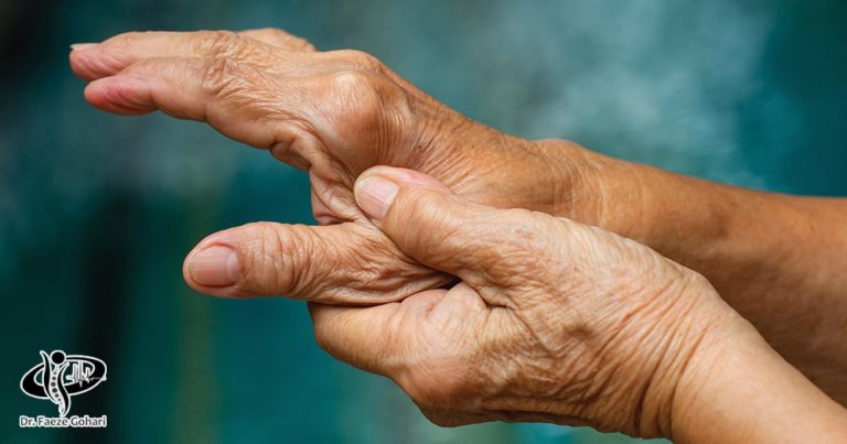 آرتروز شست دست