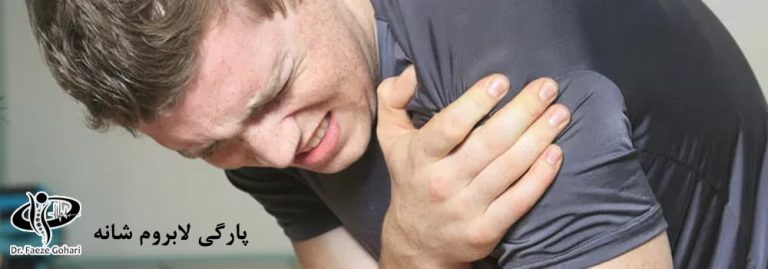 درمان پارگی لابروم شانه