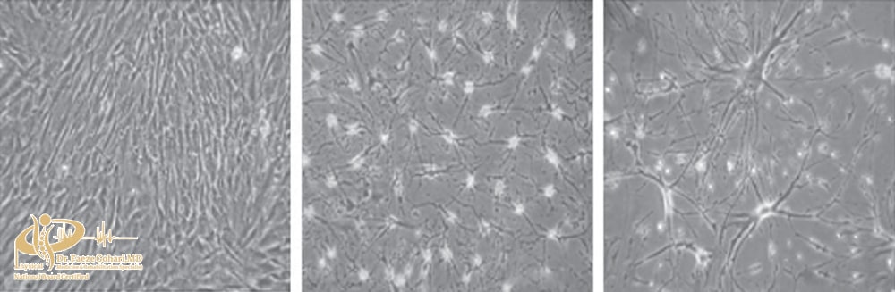 سلولهای بنیادی بالغ