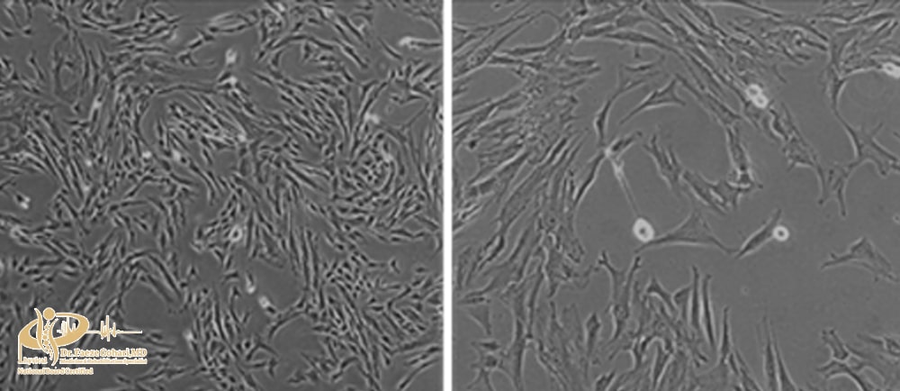 سلولهای بنیادی مزانشیمی مشتق شده از خون بندناف