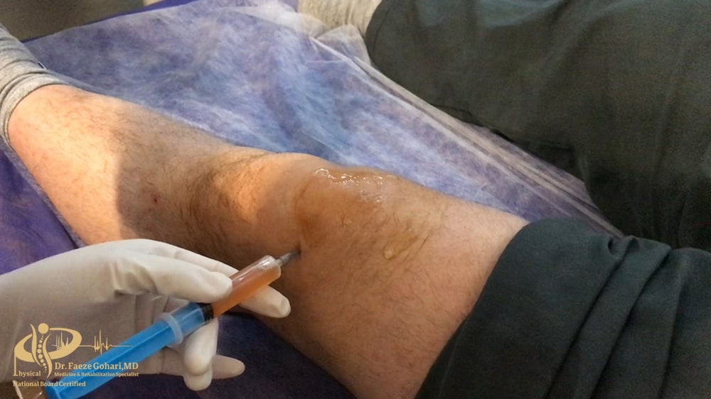 پلاسمای حاوی پلاکتها