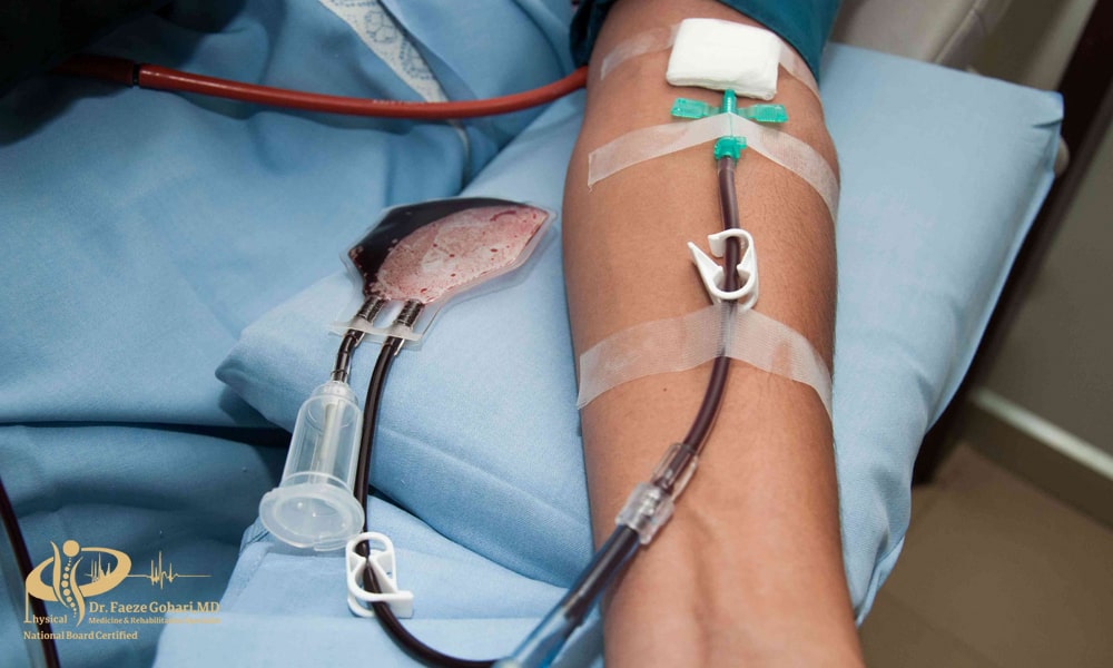 پیوند سلولهای بنیادی