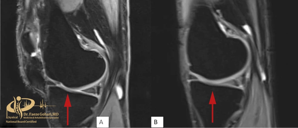 فرایند ترمیم