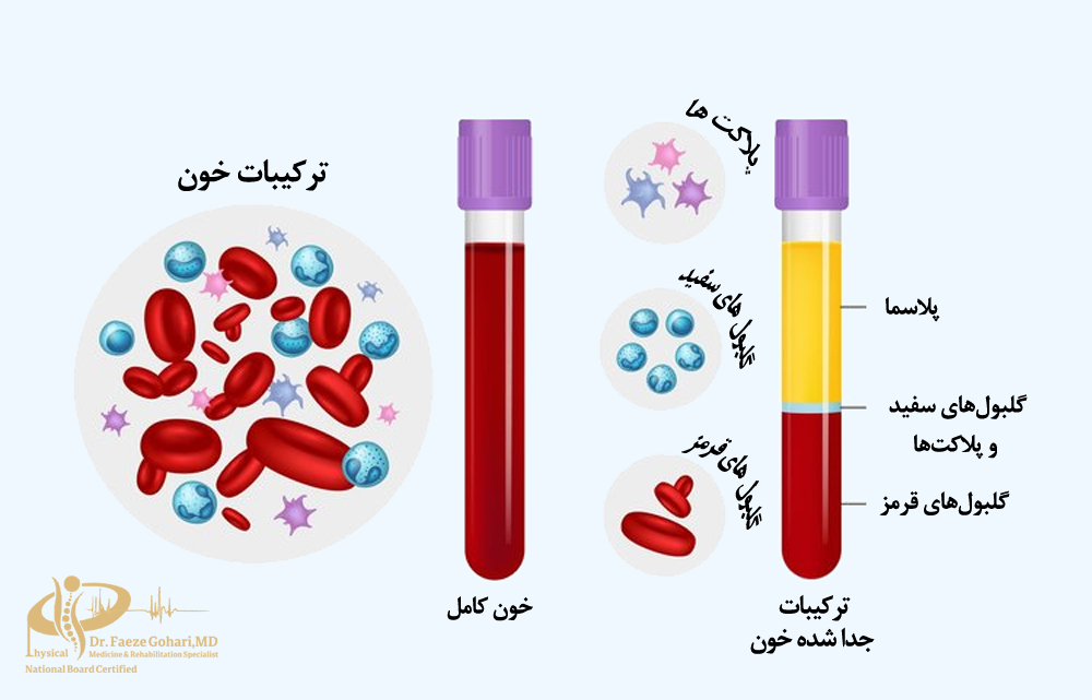 درمان با پلاسمای غنی از پلاکت